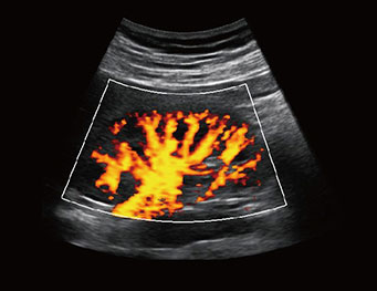 肾脏，PD 模式