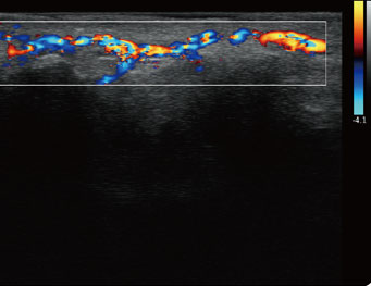 指尖血流，C 模式