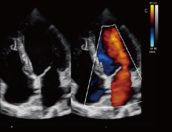 心脏，B BC 模式