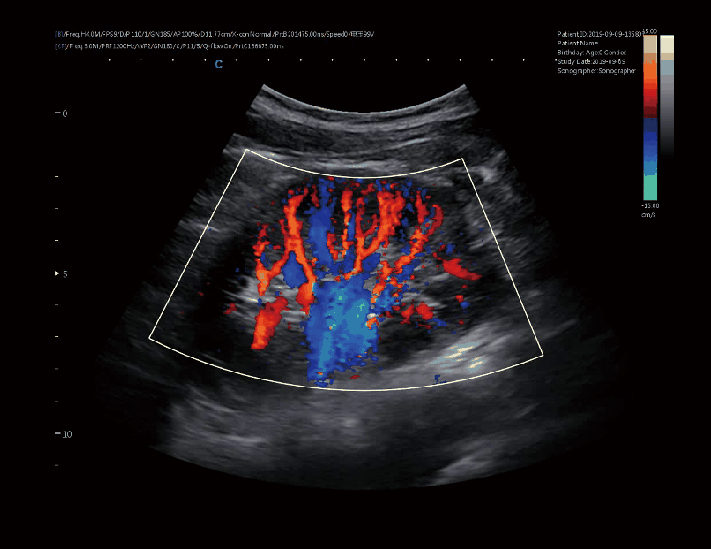 肾脏，C模式