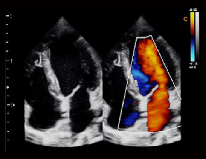 心脏，BC模式